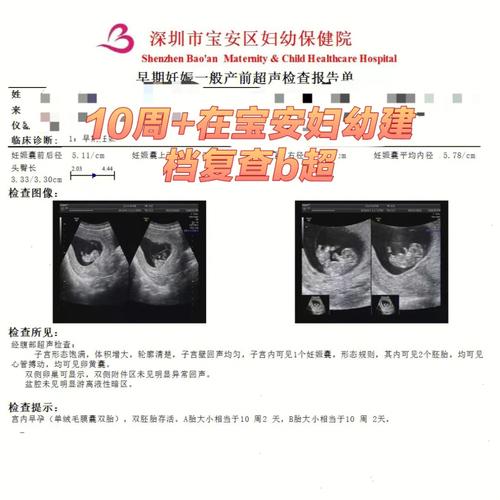 深圳试管供卵双胞胎(深圳试管供卵双胞胎:科技助力实现双喜临门)