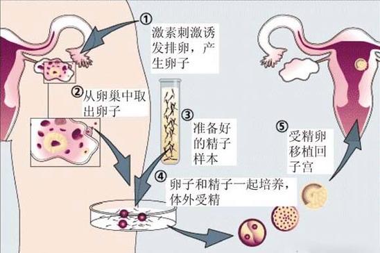 深圳供卵试管孩子包成功(深圳供卵试管孩子包成功指南)