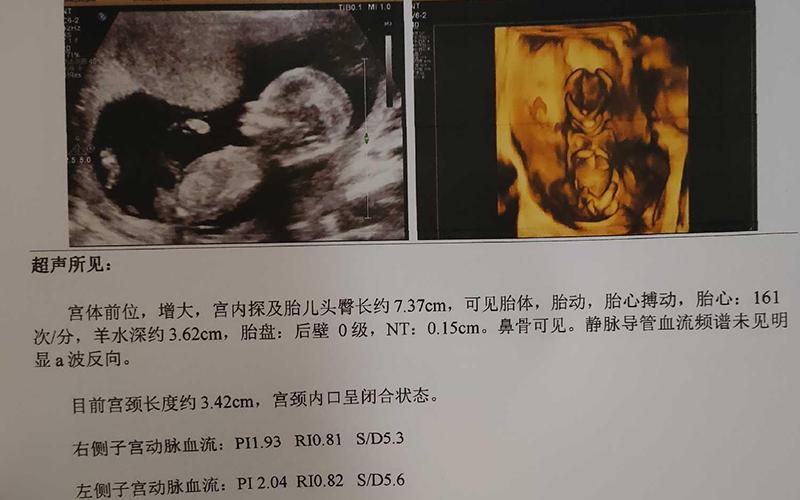 深圳三代供卵试管双胞胎【深圳三代供卵试管双胞胎:医学科技的奇迹】